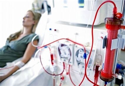 Mối nguy hiểm từ “trào lưu” lọc máu ngừa đột quỵ, tim mạch