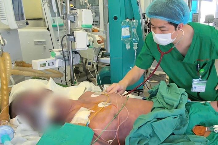 Ăn món khoái khẩu lòng lợn, người đàn ông nguy kịch do mắc liên cầu khuẩn lợn